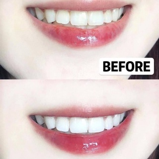 Bột tẩy trắng răng EUCRYL