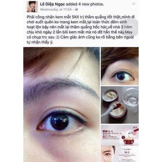 KEM MẮT HỖ TRỢ MỜ THÂM DƯỠNG MẮT SKII