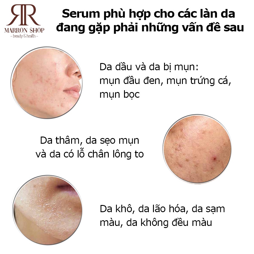 Tinh chất The Ordinary tẩy tế bào chết, cải thiện da AHA 30% BHA 2% Peeling Solution 30ml