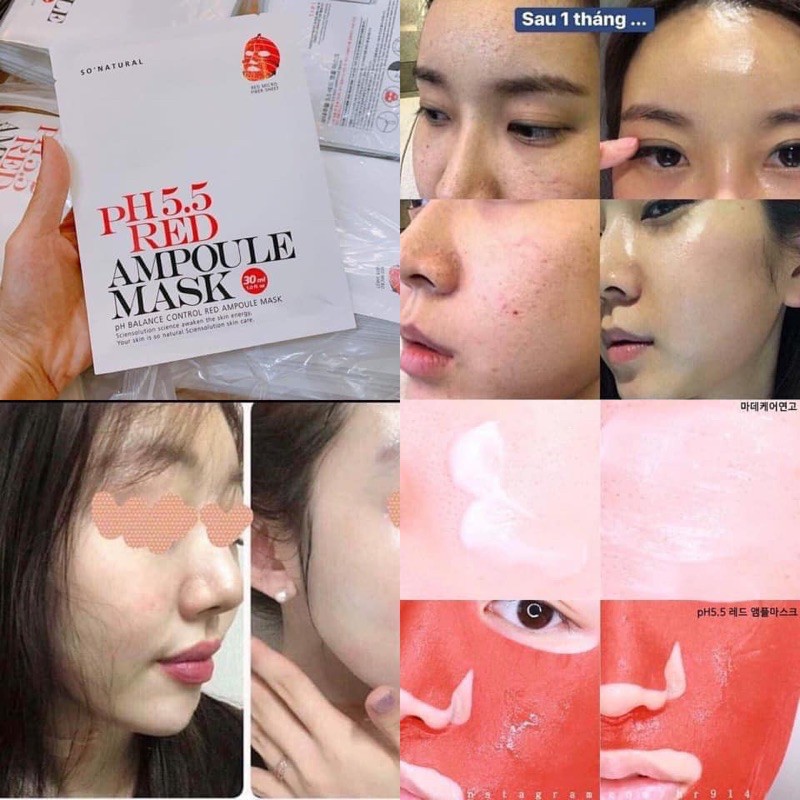 Mặt Nạ Dưỡng Da Cân Bằng pH 5.5 Red Ampoule Mask 30ml