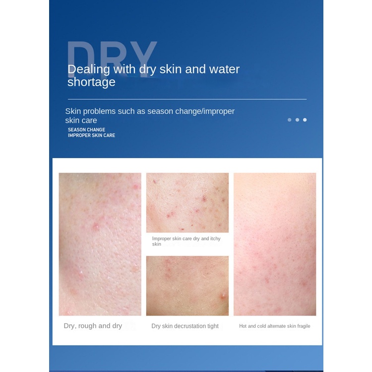 Vaseline Kem Dưỡng Ẩm Toàn Thân Vào Thu Đông Chống Nứt Nẻ Có Thể Sử Dụng Trên Toàn Thân