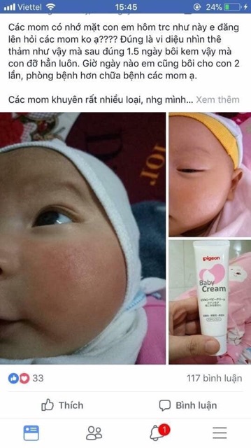 Kem nẻ Pigeon Baby Cream