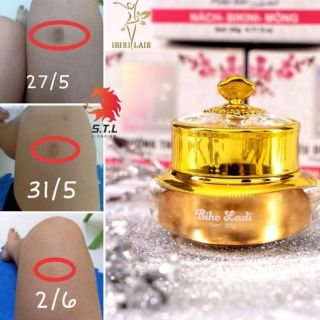 SIÊU DƯỠNG THÂM 5s BIHO LADI