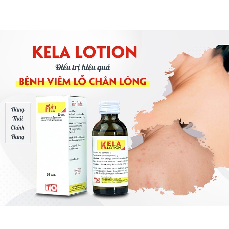 KELA LOTION dưỡng da Chống Viêm Nang, Lỗ Chân Lông 30ml