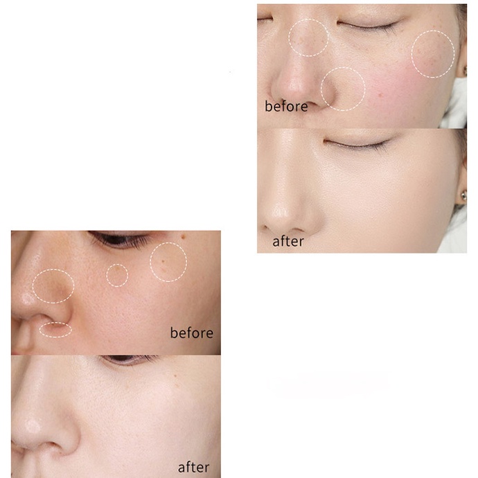 Kem Xóa Tàn Nhang, Dưỡng Trắng Da Mặt IMAGES Anti-Freckle Whitening Cream MS6054
