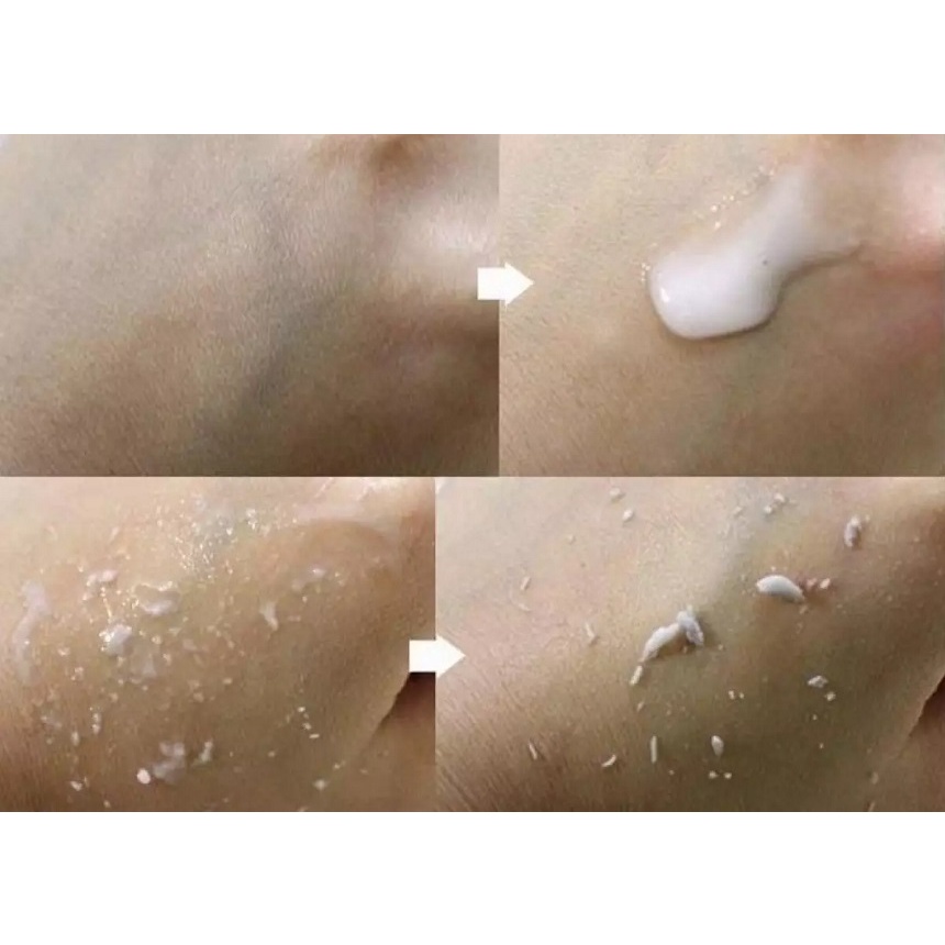 TẨY TẾ BÀO CHẾT 3W CLINIC MOISTURE PEELING GEL ( Mẫu mới)