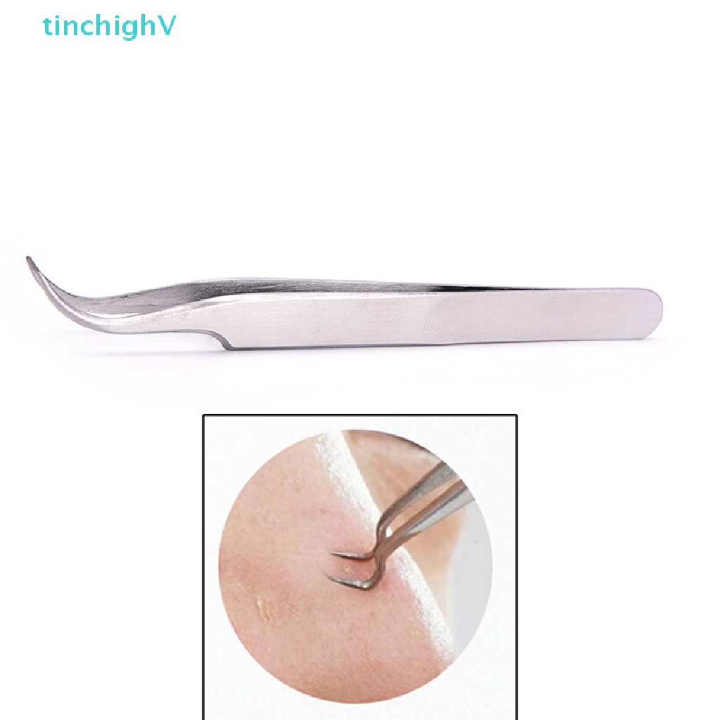 [TinchighV] Kẹp Loại Bỏ Mụn Đầu Đen Dạng Cong Làm Sạch Da Mặt
