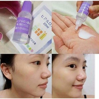Serum Hyaluronic Tươi (HA) cấp ẩm