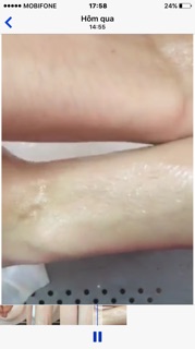 Combo 10hộp tắm trắng cam