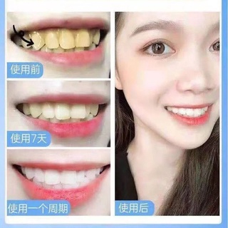 [Hàng mới về] Miếng dán làm trắng răng 5D