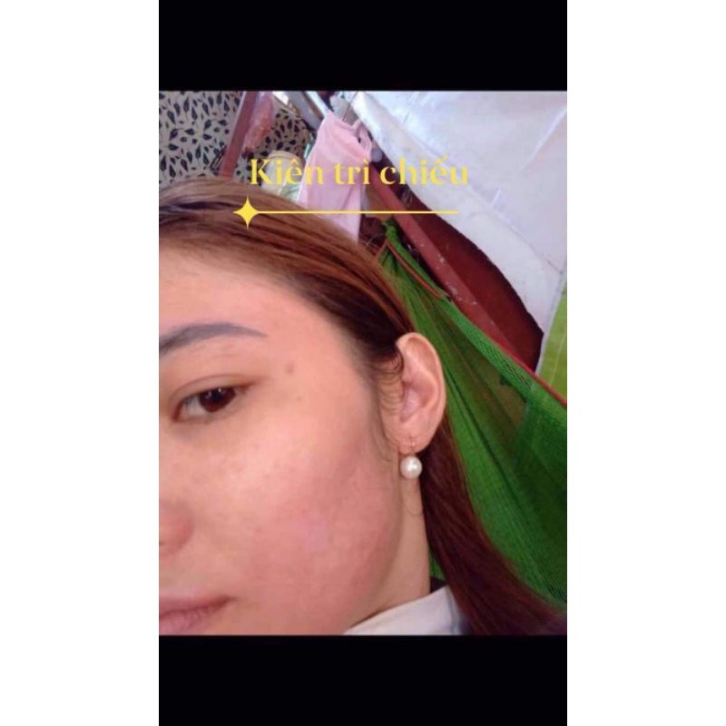 Đèn Philip UVB 311 Nm Chữa Bạch Biến - Vảy Nến - Viêm Da Cơ Địa (Hàng mới 100% chưa qua sử dụng)