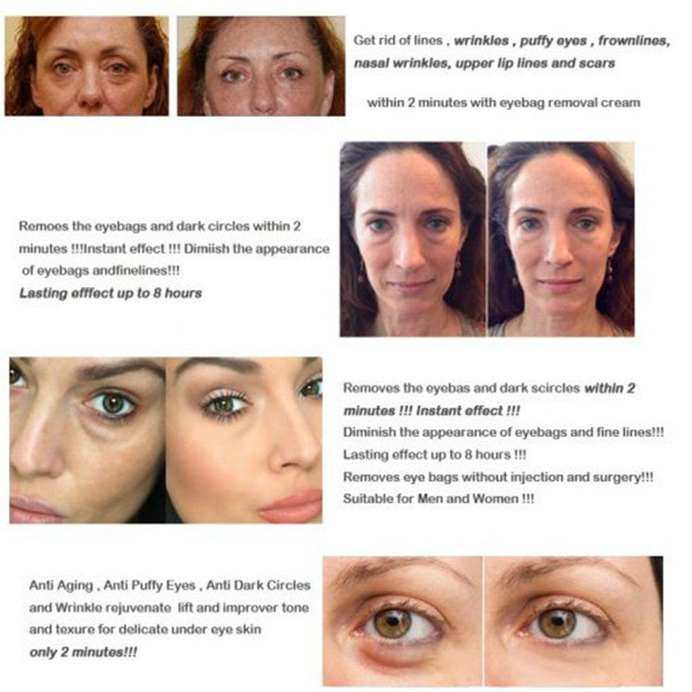 Serum Dưỡng Da Mắt Xóa Mờ Quầng Thâm / Bọng Mắt Hiệu Quả