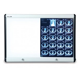 Đèn đọc phim 2 phim-Đèn đọc phim y khoa-Đèn đọc phim X quang