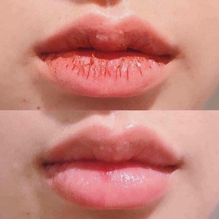 Tẩy Tế Bào Chết Môi Lip Scrub