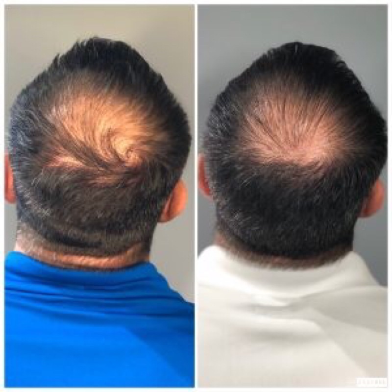 Tinh chất Copper Peptide  ✅ freeship ✅ giúp trẻ hoá da, phụ.c hồ.i da sau lăn kim