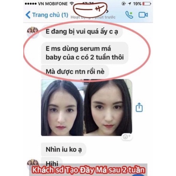 Tinh chất Mircale Pháp làm đầy má, tạo má baby chỉ sau 1 tháng(10ml)