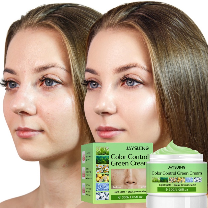 Kem Trị Tàn Nhang Làm Trắng Da Dưỡng Ẩm Chống Lão Hóa 30g