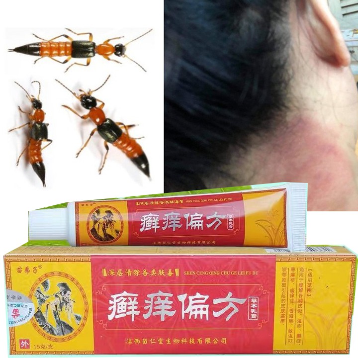 Kem bôi da liễu, Kem bôi kiến ba khoang đốt