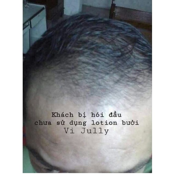 Tinh Dầu Bưởi Vi Jully Dưỡng Tóc [NHẬP OLIV5 GIẢM 4K+TẶNG VÍ] Trị Rụng Tóc-Kích Thích Mọc Tóc-Làm Dài Tóc | BigBuy360 - bigbuy360.vn