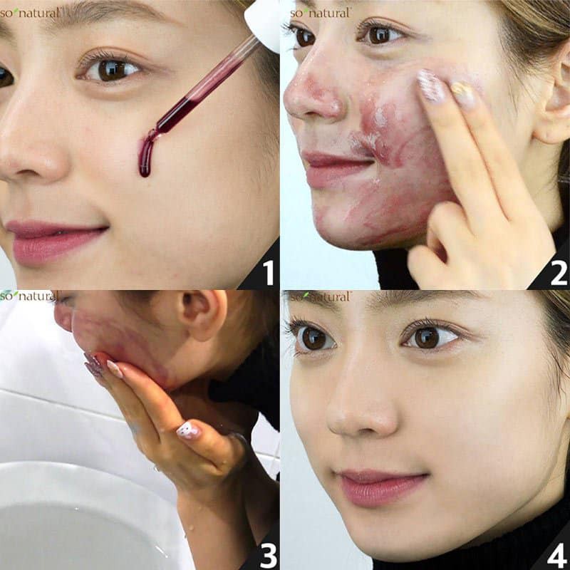 [100% AUTH]- 55ML- Tẩy Tế Bào Chết Hóa Học Red Peel Tingle Serum | BigBuy360 - bigbuy360.vn