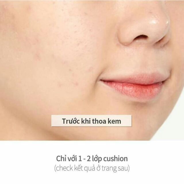 💛Phấn nước thần thánh Arpil skin