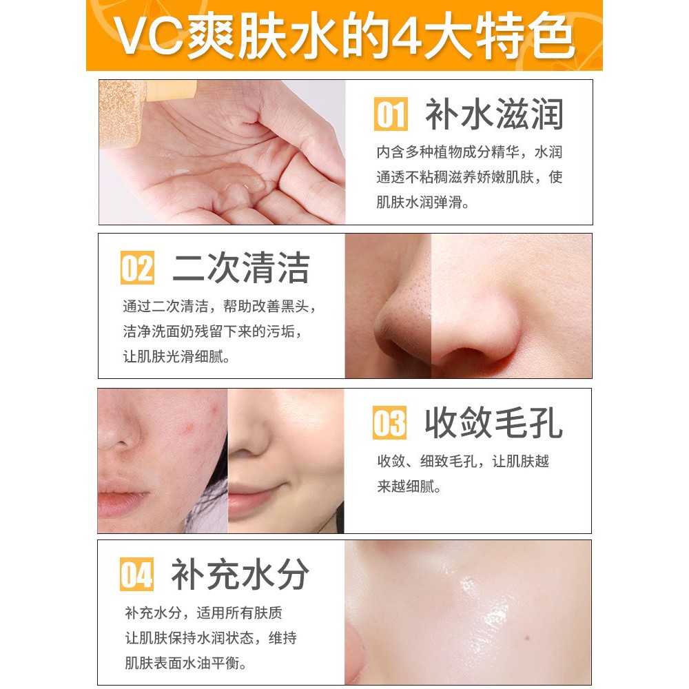 Nước hoa hồng VC 300ml | BigBuy360 - bigbuy360.vn