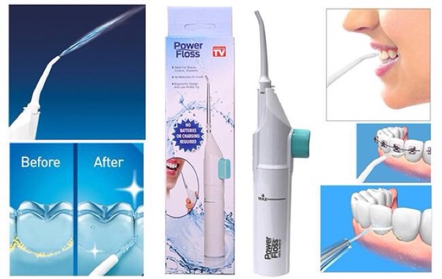 MÁY TĂM NƯỚC VỆ SINH RĂNG MIỆNG POWER FLOSS