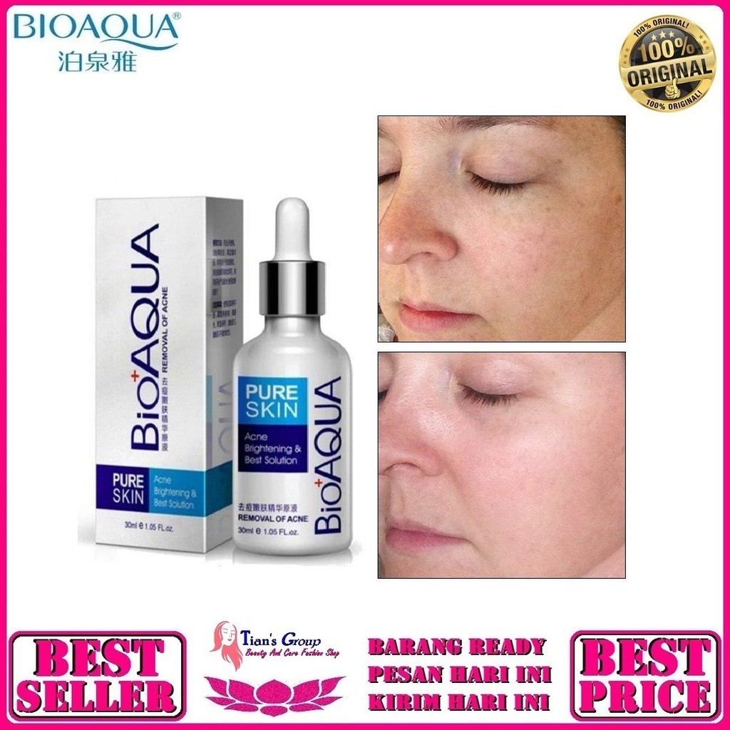 (hàng Mới Về) Serum Trị Mụn Bioaqua Chính Hãng Chất Lượng Cao