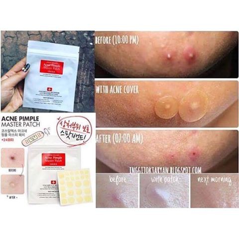 Miếng Dán Mụn Sưng Cosrx Acne Pimple &amp; Clear Fit Master Patch