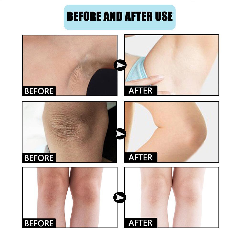 Kem Dưỡng Trắng Da Vùng Dưới Cánh Tay/Đầu Gối/Vùng Bikini Hiệu Quả O9Q5