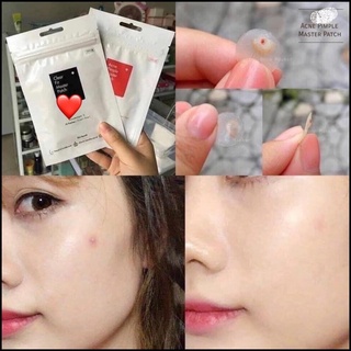 Miếng dán mụn Cosrx Acne Pimple Master Patch (Đỏ-Đen)