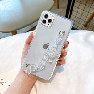 Ốp xích gấu màu trắng