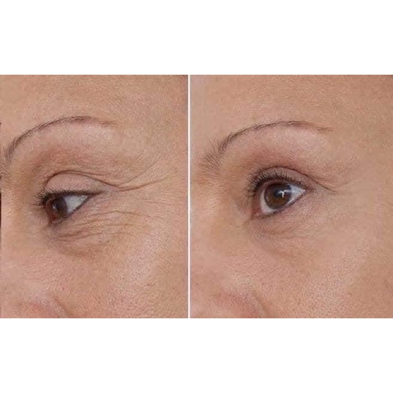 Gói kem chống nhăn khóe mắt whoo đỏ Intensive Wrinkle Concentrate 1ml