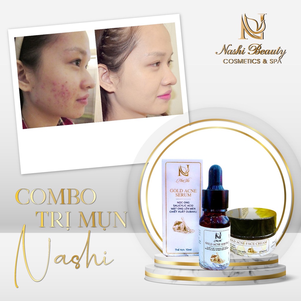 Combo Hỗ Trợ Làm Giảm Mụn Sưng Mụn Kích Ứng