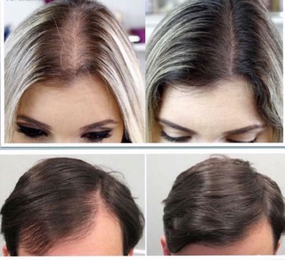 VIÊN UỐNG ĐẸP DA, MỌC TÓC, KHOẺ MÓNG PHYTO