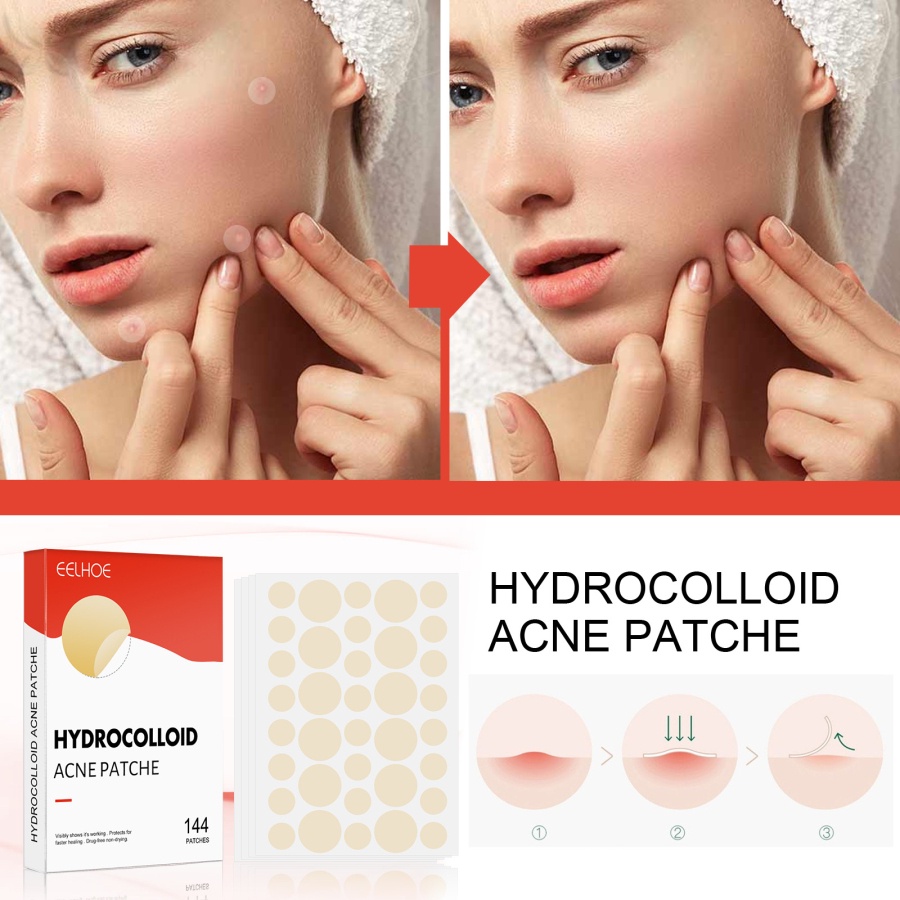 Miếng Dán Hỗ trợ giảm mụn Hydro Hydro Hydro Hydro hydroclloid Vô Hình Thoáng Khí Chống Thấm Nước