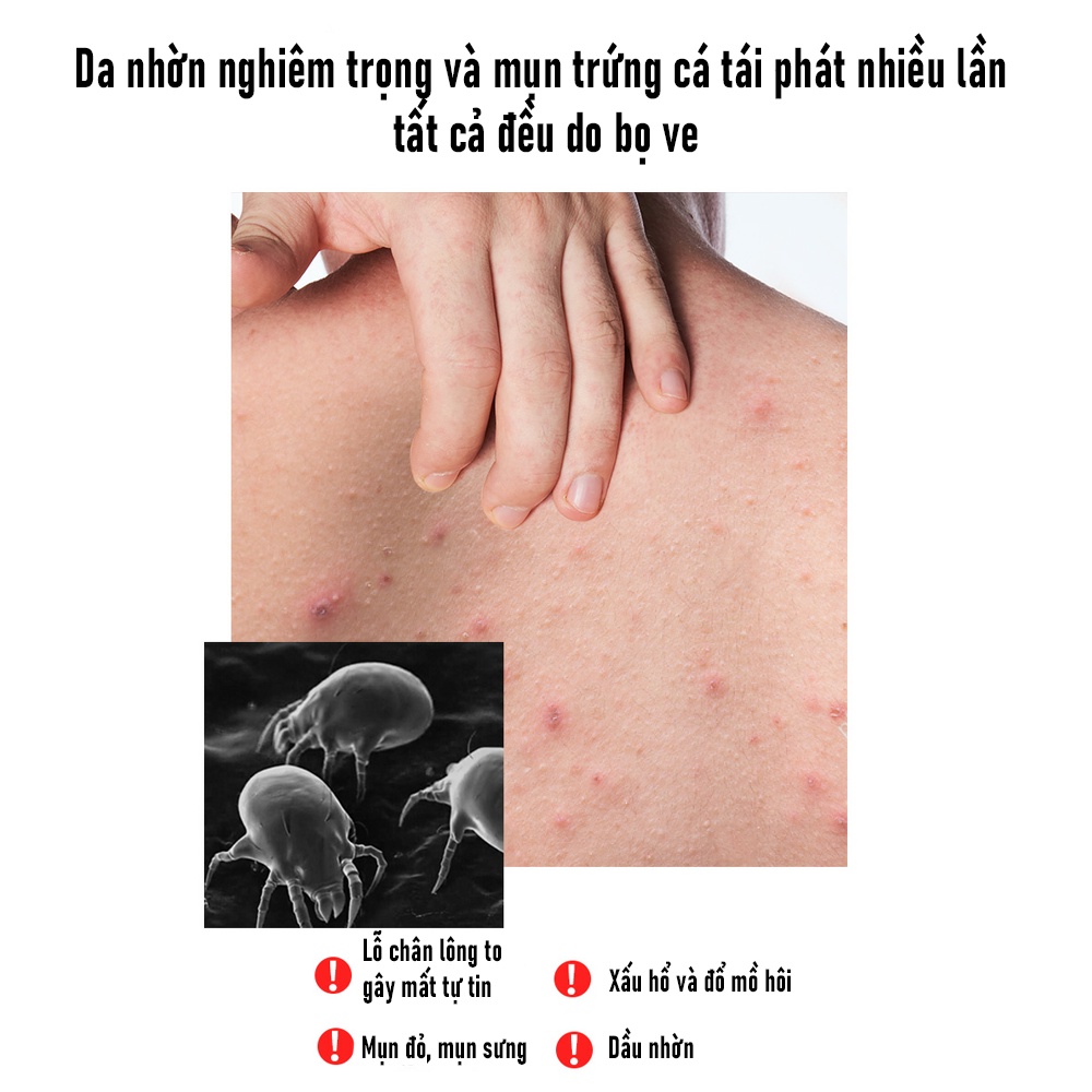 Sữa Tắm Nam Blueman Hương Nước Hoa Thơm Lâu Anti Acne Giảm Mụn Lưng Mờ Thâm 500ml