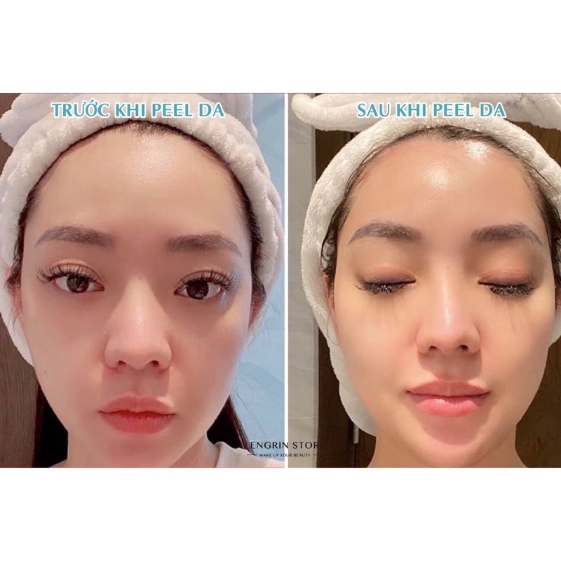 PEEL DA TẠI NHÀ NEOSTRATA RETINOL PEEL (1 ỐNG)