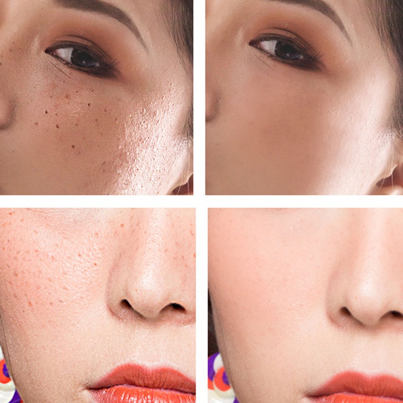 Bút Tẩy Nốt Ruồi Làm Đẹp Mini Cổng Usb