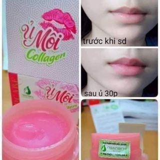Ủ môi colagen mỹ phẩm ngân bình