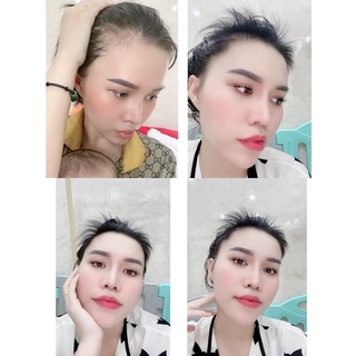 HUYẾT THANH SERUM MỌC TÓC WEILAIYA