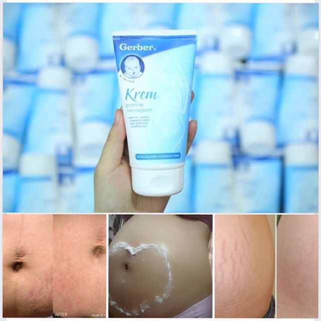 Kem chống rạn da Gerber Krem 150ml