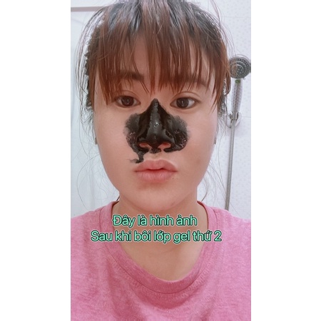 Gel lột mụn than tre kone thái lan