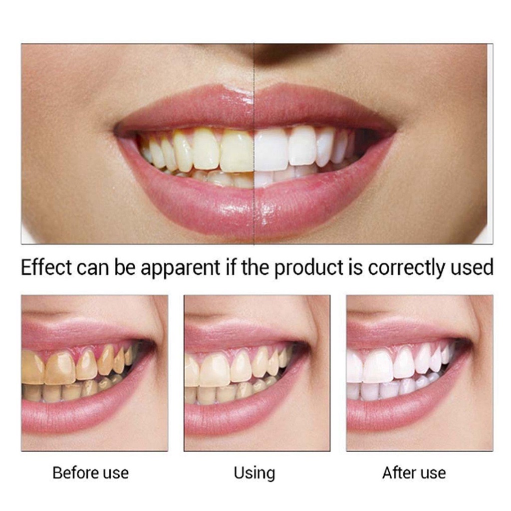 Tinh Chất Làm Trắng Răng Chăm Sóc Sức Khỏe Răng Miệng Halitosis