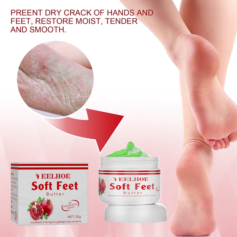 Kem Dưỡng Da Tay Chân Dạng Lột Chống Khô Nứt 30g