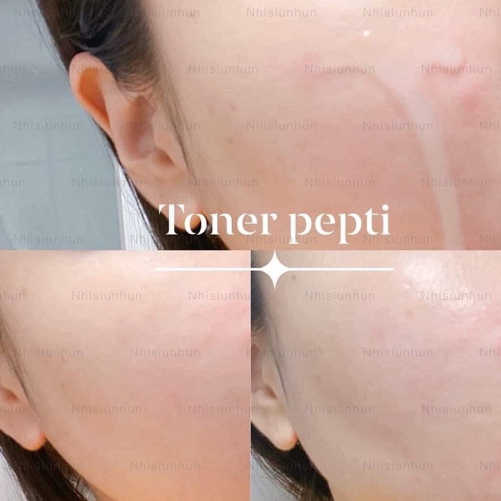 Nước hoa hồng Dr.pepti centella toner