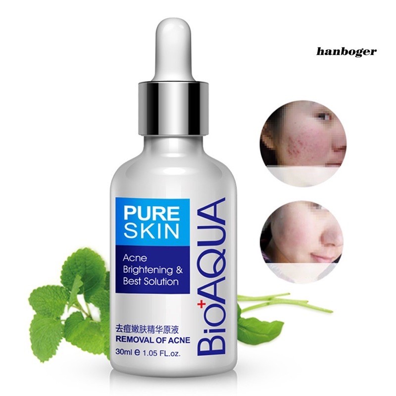 Tinh Chất Hỗ Trợ Loại Bỏ Mụn Làm Mờ Sẹo Kiểm Soát Dầu  BiOAqua Dưỡng Trắng Da 30ml