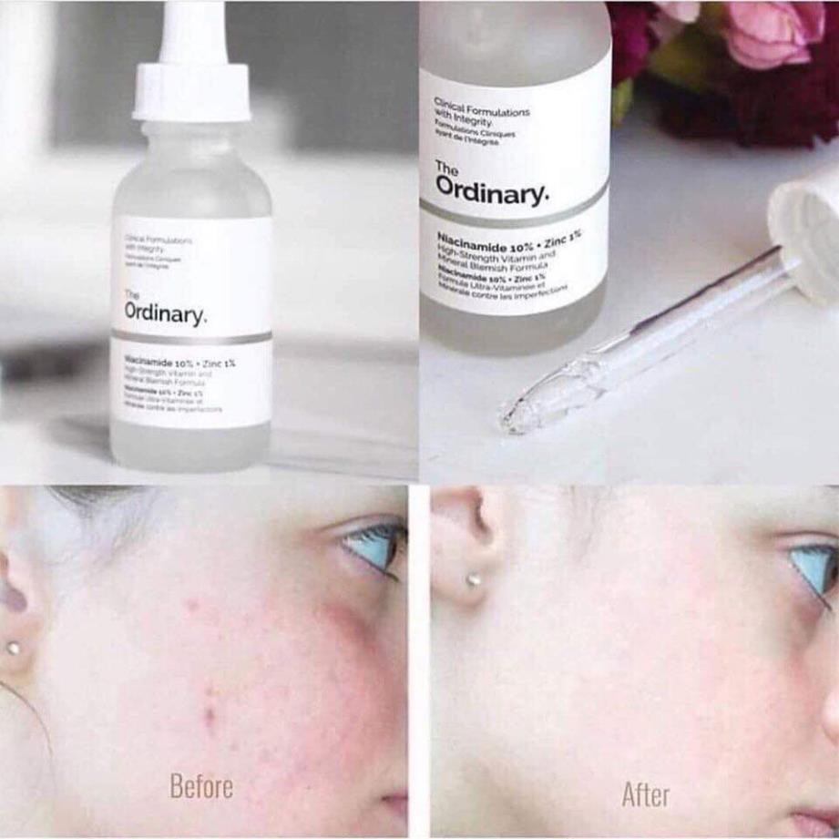 (AUTH) Tinh chất giảm mụn The Ordinary Niacinamide 10% + Zinc 1% ( 30mL ) | BigBuy360 - bigbuy360.vn