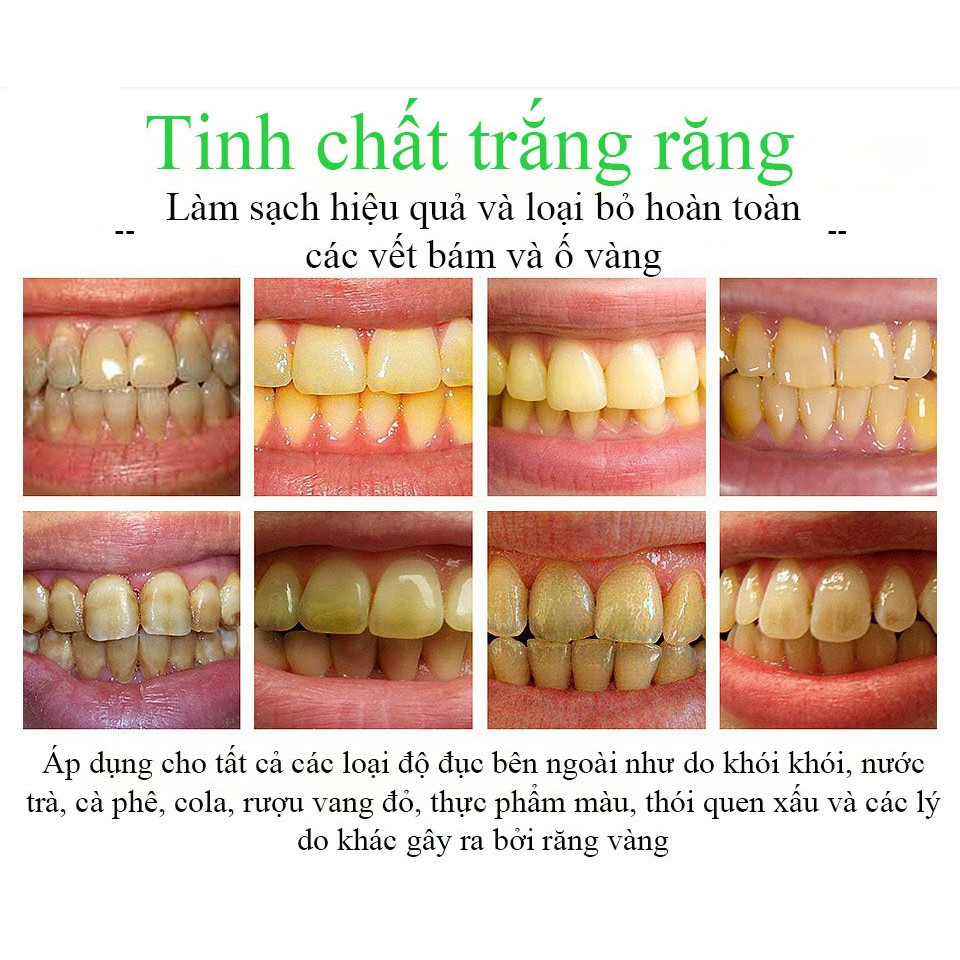 [CHÍNH HÃNG] VIBRANT GLAMOUR BÚT TẨY TRẮNG RĂNG LÀM SẠCH TRẮNG RĂNG WHITENING TEETH TREATMENT