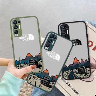 Ốp điện thoại in hình cho Redmi Note 10 8 7 9 9S 10s Pro Max Mi 9T Redmi 9T 9A 9 9i Xiaomi Mi 9T Pro Poco X2 F147
